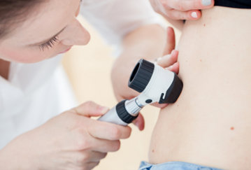 Skin Cancer: Why Regular Checkups Are Important!